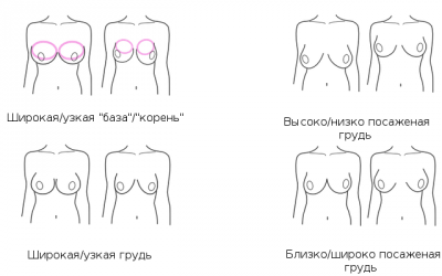 breast_shape.png